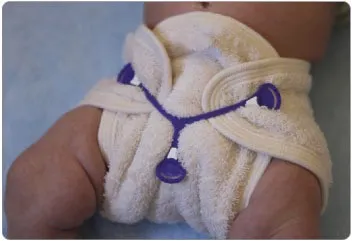 Snappi Baby - Diaper Fastener (Triple Pack)